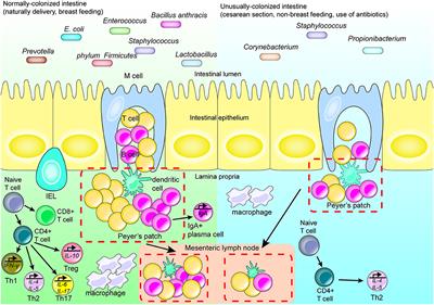 Intestinal Flora and Disease Mutually Shape the Regional Immune System in the Intestinal Tract